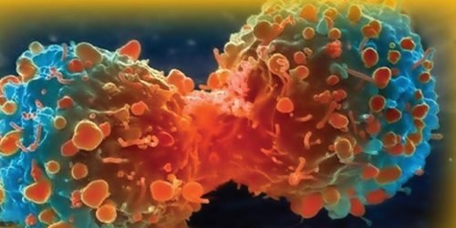 Cancer Management