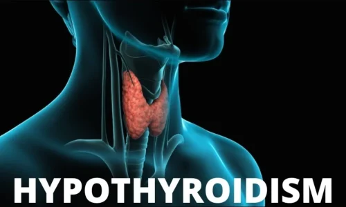 Thyroid ( hyper Hypo)