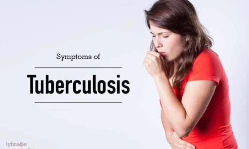 tuberculosis Koch’s